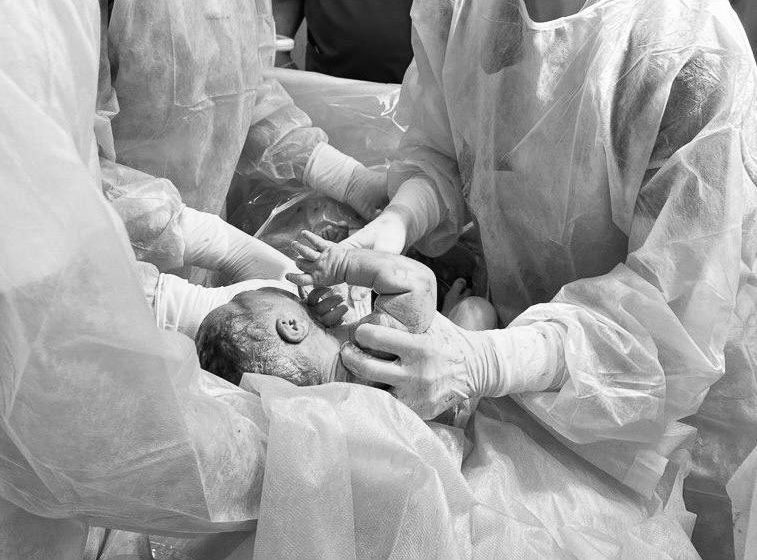  Подмосковные врачи помогли родить женщине с двумя матками и огромной грыжей